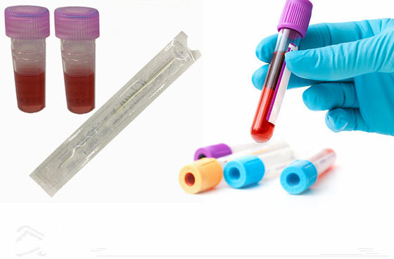 Συγκεντρωμένες στοματικές πατσαβούρες DNA για δειγματοληψίας τη νάυλον πατσαβούρα μεταφορών ινών αποστειρωμένη με το σωλήνα